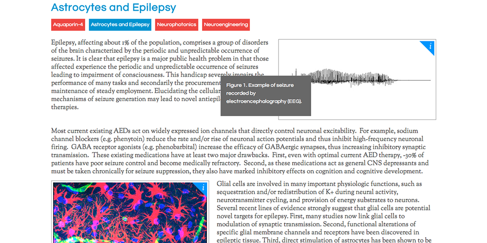 Translationa Neuroscience Laboratory Research Page